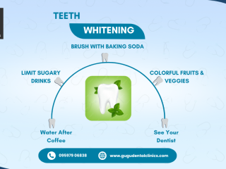 Teeth Whitening tips- Gugu Dental clinic, Coimbatore